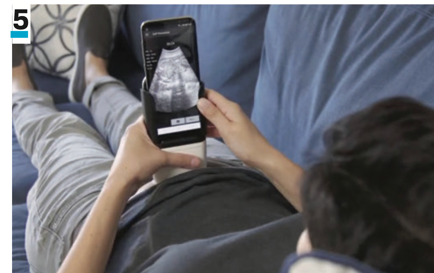 5. PulseNmore ES is an ultrasound device for home use. Credit: Good Design Awards and The Chicago Athenaeum.