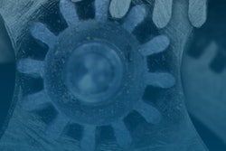 End users and OEMs might be more cautious with remote service monitoring than conventional wisdom suggests.